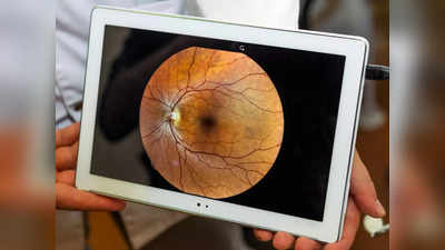 Eye Test App: अब मोबाइल ऐप से कुछ ही सेकंड में पता चल जाएगा मोतियाबिंद है या नहीं