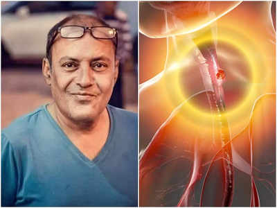 Cancer Symptoms: ক্যানসারকে গ্যাস ভেবে আপনিও ভুল করছেন না তো? অভিনেতা Subhomoy Chatterjee-এর প্রাণ নিয়েছে এই রোগ!