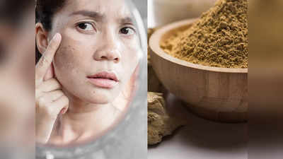 Acne And Pimples Treatment: ব্রণর সমস্যা বছরভর? করিনার পুষ্টিবিদের এই ৩ পরামর্শ মানলেই ম্যাজিক