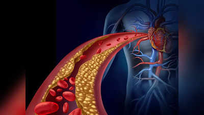Cholesterol: হাই কোলেস্টেরল থাকলে এই ৫ প্রাণঘাতী রোগ পিছনে পড়ে! সতর্ক করলেন চিকিৎসক