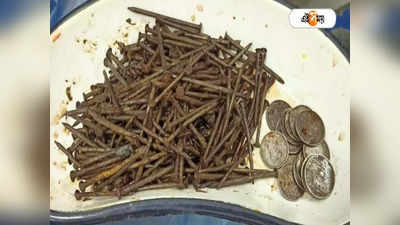 Bardhaman News: পেটের ভিতর জমে ২৫০টি পেরেক, কয়েন ও স্টোন চিপস! জটিল অস্ত্রোপচারে সফল বর্ধমান মেডিক্যাল