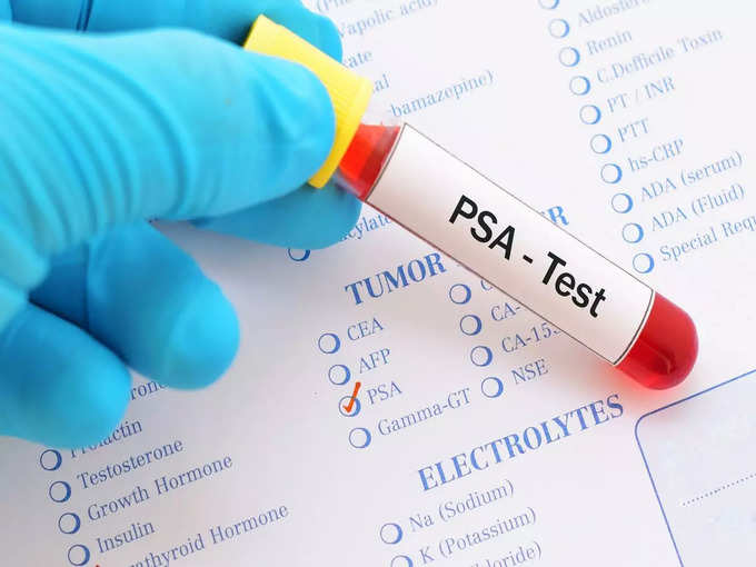 प्रोस्टेट-स्पेसिफिक एंटीजन (PSA) टेस्ट