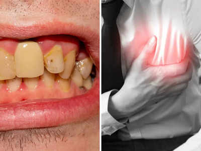 Oral health: मुंह की दुर्गंध-दांतों में कीड़े, मसूड़ों में गलन का तुरंत करवाएं इलाज, संक्रमण से शरीर में हो जाती है ये 5 गंभीर बीमारी