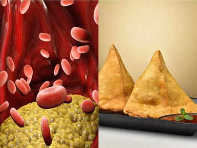 High cholesterol foods: CDC की सलाह- बस ये 4 चीजें न खाएं, जीवन में कभी नहीं बढ़ेगा कोलेस्ट्रॉल