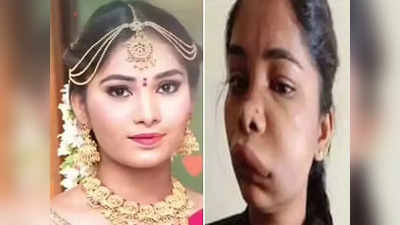 முகம் விகாரமாகிவிட்டது: டாக்டர் மீது கேஸ் போடும் நடிகை ஸ்வாதி