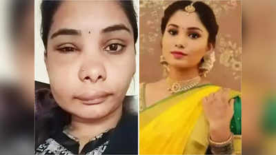 Swathi Sathish:  রুট ক্যানাল করাতে গিয়ে বিপাকে অভিনেত্রী, বদলে গেল চেহারা! হাতছাড়া কাজ