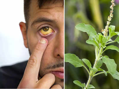 Jaundice Treatment: ওষুধ নয়, এই ৫ পাতাই জন্ডিসকে গোড়া থেকে দূর করবে, লিভারও হবে শক্তিশালী!