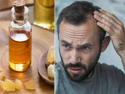 Best Hair Oils For Men: ছেলেদের টাক পড়বে না, চুলে লাগান এই সেরা তেল...