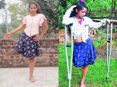 One Leg Dancer Jharkhand: हादसे ने छीने पैर लेकिन हौसला न तोड़ पाया, जानिए झारखंड की वन लेग डांसर रेखा मिश्रा के बारे में