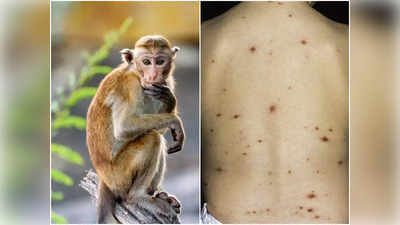 Monkeypox Virus: আতঙ্কের নতুন নাম মাঙ্কিপক্স ভাইরাস! এর লক্ষণ, চিকিৎসা, প্রতিরোধের উপায় জানাচ্ছেন চিকিৎসক
