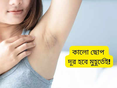 Dark Underarms: স্লিভলেস পরার আগেই দূর করুন বগলে কালো ছোপ! এই ঘরোয়া টোটকায় কাজ হবে চটজলদি