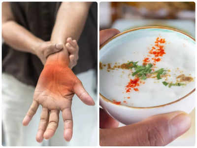 Curd in uric acid: खून में बढ़ा है यूरिक एसिड तो तुरंत बना लें इस सफेद चीज से दूरी, आयुर्वेद में है न खाने की सलाह