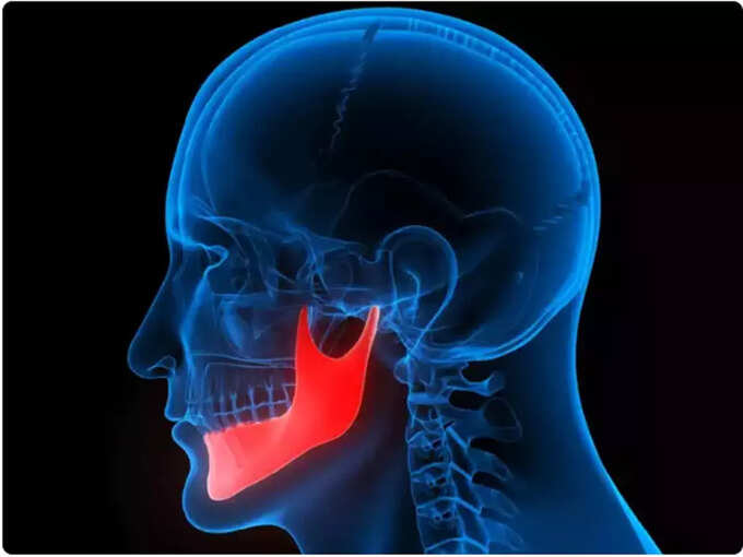 ​कोलेस्ट्रॉलमुळे जबडे दुखतात