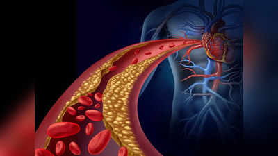 Cholesterol: বাড়ছে Heart Attack, বাঁচতে কোন বয়স থেকে কোলেস্টেরল টেস্ট জরুরি? জানাচ্ছেন চিকিৎসক
