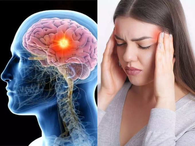 सिरदर्द कोरोना का सबसे बड़ा लक्षण