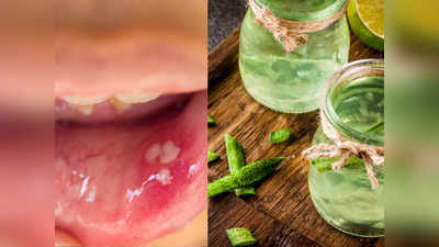 Mouth Ulcer Home Remedy: ওষুধ খেয়েও মুখের আলসার ভালো হচ্ছে না? এই ৫টি জিনিস খেলে বাঁচবে ডাক্তারের ফি