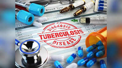 Tuberculosis Treatment News: अब 6 महीने में भी कम समय होगा टीबी का इलाज, एक्सपर्ट ने शुरू की स्टडी