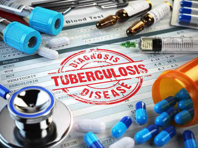Tuberculosis Treatment News: अब 6 महीने में भी कम समय होगा टीबी का इलाज, एक्सपर्ट ने शुरू की स्टडी