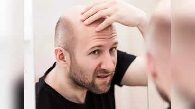 <strong>Hair Fall : </strong>प्रचंड केसगळतीमुळे आलीये टक्कल पडण्याची वेळ? प्रसिद्ध होमियोपॅथी डॉक्टरनी सांगितल्या 10 गोष्टी, झटक्यात बंद होईल हेअरफॉल..!