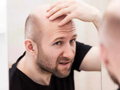 <strong>Hair Fall : </strong>प्रचंड केसगळतीमुळे आलीये टक्कल पडण्याची वेळ? प्रसिद्ध होमियोपॅथी डॉक्टरनी सांगितल्या 10 गोष्टी, झटक्यात बंद होईल हेअरफॉल..!