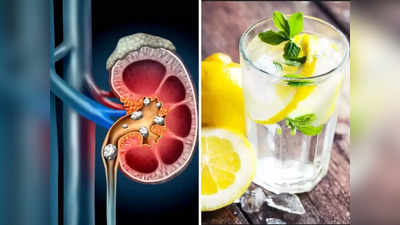 Home Remedy for Kidney Stone: किडनी स्टोन से है परेशान? इन 3 तरीकों से करें नींबू का इस्तेमाल, कुछ ही दिनों में गलने लगेगी पथरी