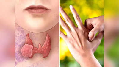 नहीं पड़ेगी दवा की जरूरत, Thyroid को कंट्रोल रखने के लिए Ayurveda के बस ये 4 उपाय हैं काफी