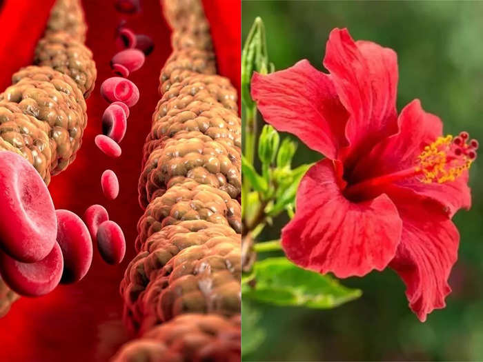 according to a study hibiscus flower can reduce bad cholesterol naturally