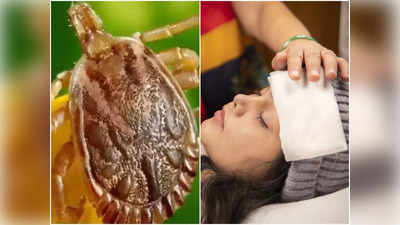 Scrub Typhus: স্ক্রাব টাইফাসও হতে পারে প্রাণঘাতী! লক্ষণ, চিকিৎসা নিয়ে মুখ খুললেন চিকিৎসক