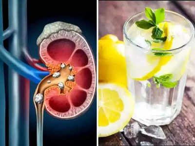 <strong>Home Remedy for Kidney Stone : </strong>मुतखडा किंवा किडनी स्टोनने आहात त्रस्त? ‘या’ 3 पद्धतींनी करा लिंबूचा वापर, काहीच दिवसांत नैसर्गिकरित्या गळून पडेल मुतखडा..!