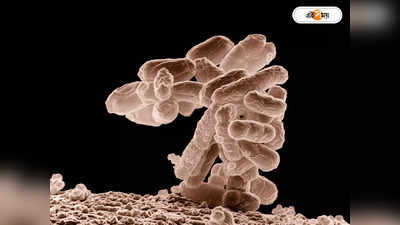 Marburg Virus: মাঙ্কিপক্সের পর নয়া আতঙ্কের নাম মারবার্গ! ২ আক্রান্তের মৃত্যুতে উদ্বিগ্ন WHO
