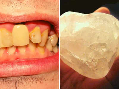 Health Benefits of Alum: ऐंठन-सूजन से लेकर दांतों की सड़न तक इन 10 प्रॉब्लम का तोड़ है ये पत्थर, ऐसे करें इस्तेमाल