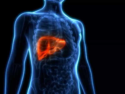 fatty liver: கல்லீரல் கொழுப்பு உள்ளவர்கள் சாப்பிடக் கூடாத 6 உணவுகள்...