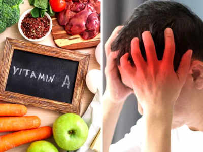 ज्यादा Vitamin A दिमाग की नसों को करती हैं कमजोर, हो सकती हैं ये 10 बीमारी, बचाव के लिए खाना शुरू कर दें ये 10 चीजें