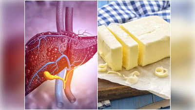 Fatty Liver: ওষুধ নয়, এই কয়েকটি কাজেই কমবে ফ্যাটি লিভার! জানুন চিকিৎসকের মুখে