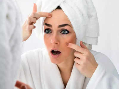 how to avoid acne breakout : ഈ കാരണങ്ങള്‍ അറിഞ്ഞാല്‍ മുഖക്കുരു വരുന്നത് ഒഴിവാക്കാം...