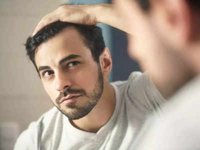 hair loss from temple and hair line:നെററിയില്‍ കഷണ്ടി കയറുന്നതിന് കാരണം, പരിഹാരം....