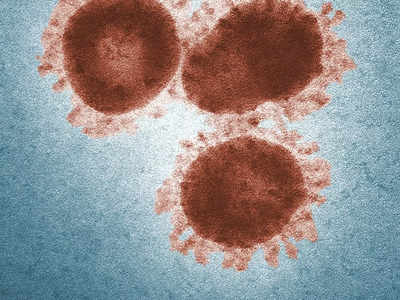 Marburg Virus: അതീവ അപകടകാരിയായ വൈറസ്, ഇതൊക്കെ രോഗലക്ഷണങ്ങള്‍