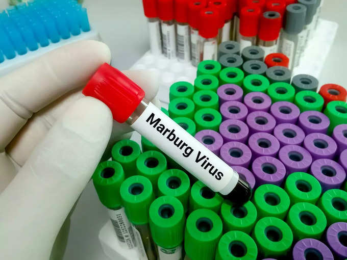 मारबर्ग वायरस रोग क्या उपचार है?