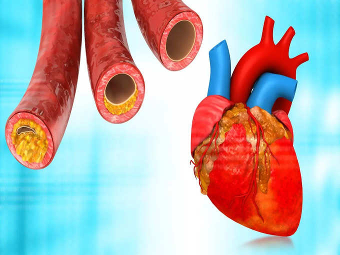 हृदय रोग का जोखिम हो सकता है कम