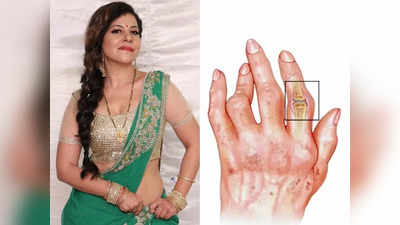 Sambhavna Seth को हुई अजीब लाइलाज बीमारी, हाथ-पैरों में रहती है अकड़न, लड़कियां नजरअंदाज न करें ये 5 लक्षण