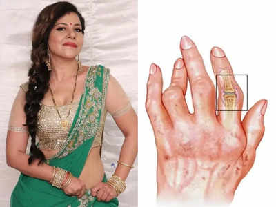 Sambhavna Seth को हुई अजीब लाइलाज बीमारी, हाथ-पैरों में रहती है अकड़न, लड़कियां नजरअंदाज न करें ये 5 लक्षण