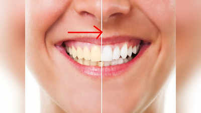 Teeth Whitening: দু’দিনেই হলুদ ছোপ হবে উধাও! ঝকঝকে সাদা দাঁত পেতে কাজে লাগান এই ঘরোয়া টোটকা