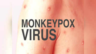 Monkeypox: मंकीपॉक्स को लेकर टेंशन में भारत सरकार, हाई लेवल मीटिंग हुई, धीरे-धीरे बढ़ रहे केस