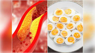 High cholesterol Foods: এই চেনা খাবারগুলি খেলেই রক্তনালীতে জমে প্রাণঘাতী কোলেস্টেরল! চিকিসকের মুখেই জানুন