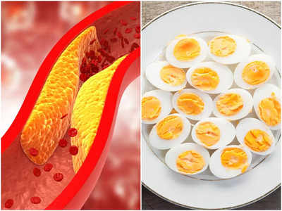 High cholesterol Foods: এই চেনা খাবারগুলি খেলেই রক্তনালীতে জমে প্রাণঘাতী কোলেস্টেরল! চিকিসকের মুখেই জানুন