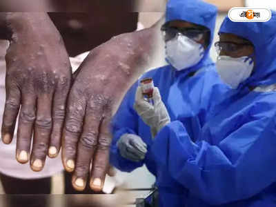 Monkeypox India: আক্রান্তের সংস্পর্শে আসা ব্যক্তিরা নেগেটিভ, মাঙ্কিপক্স নিয়ে গুরুত্বপূর্ণ তথ্য জানাল কেরালা সরকার