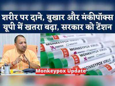 Monkeypox Alert: मंकीपॉक्स की आहट से UP सरकार हुई सतर्क, अस्पतालों में रिजर्व हुए बेड्स