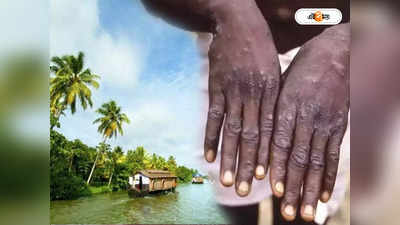 Monkeypox India: নতুন ভাইরাস এলে বার বার কেন হটস্পট হয় কেরালা? উত্তর খুঁজলেন বিশেষজ্ঞরা