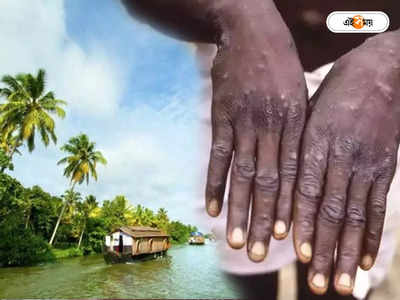Monkeypox India: নতুন ভাইরাস এলে বার বার কেন হটস্পট হয় কেরালা? উত্তর খুঁজলেন বিশেষজ্ঞরা