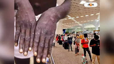 Monkeypox India: ভারতে মাঙ্কিপক্স আতঙ্ক! একাধিক বিমানবন্দরে জারি সতর্কতা